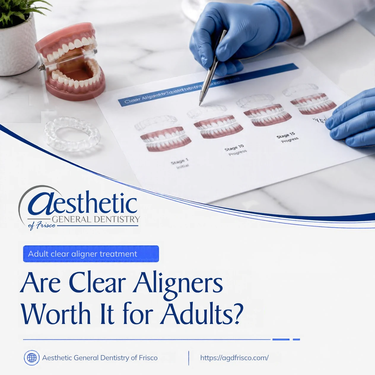 Are Clear Aligners Worth It for Adults?