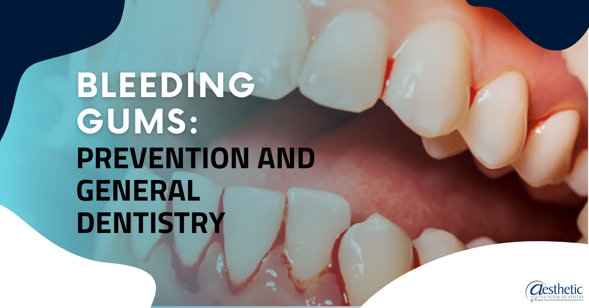 Bleeding Gums Prevention and General Dentistry