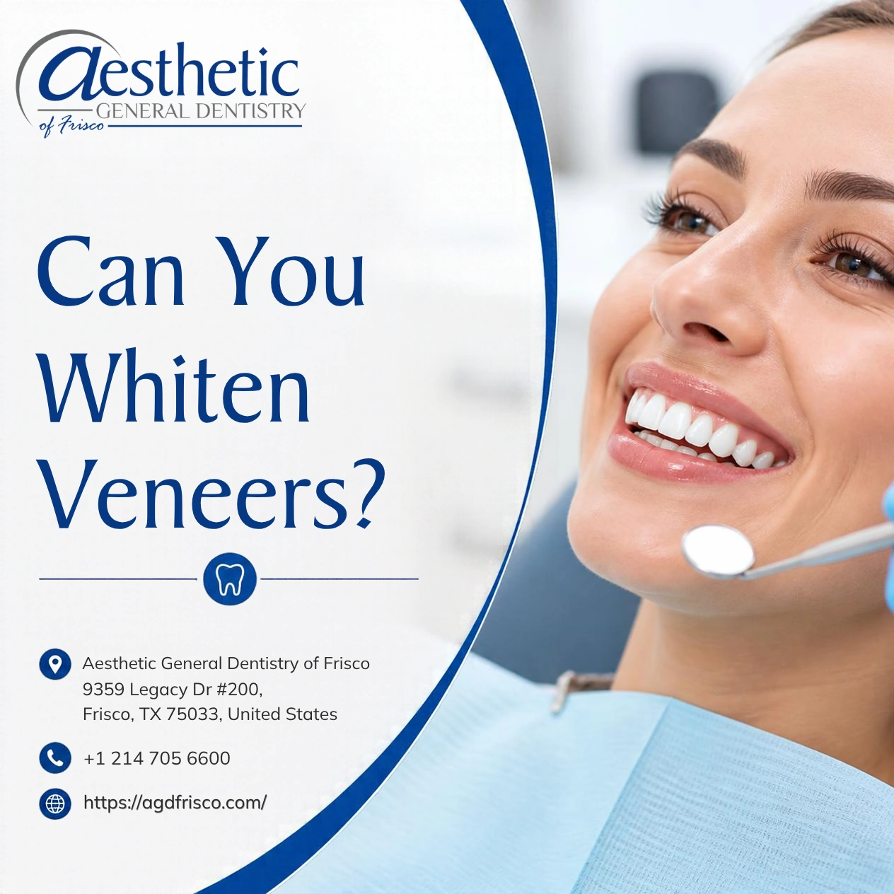 Can You Whiten Veneers?
