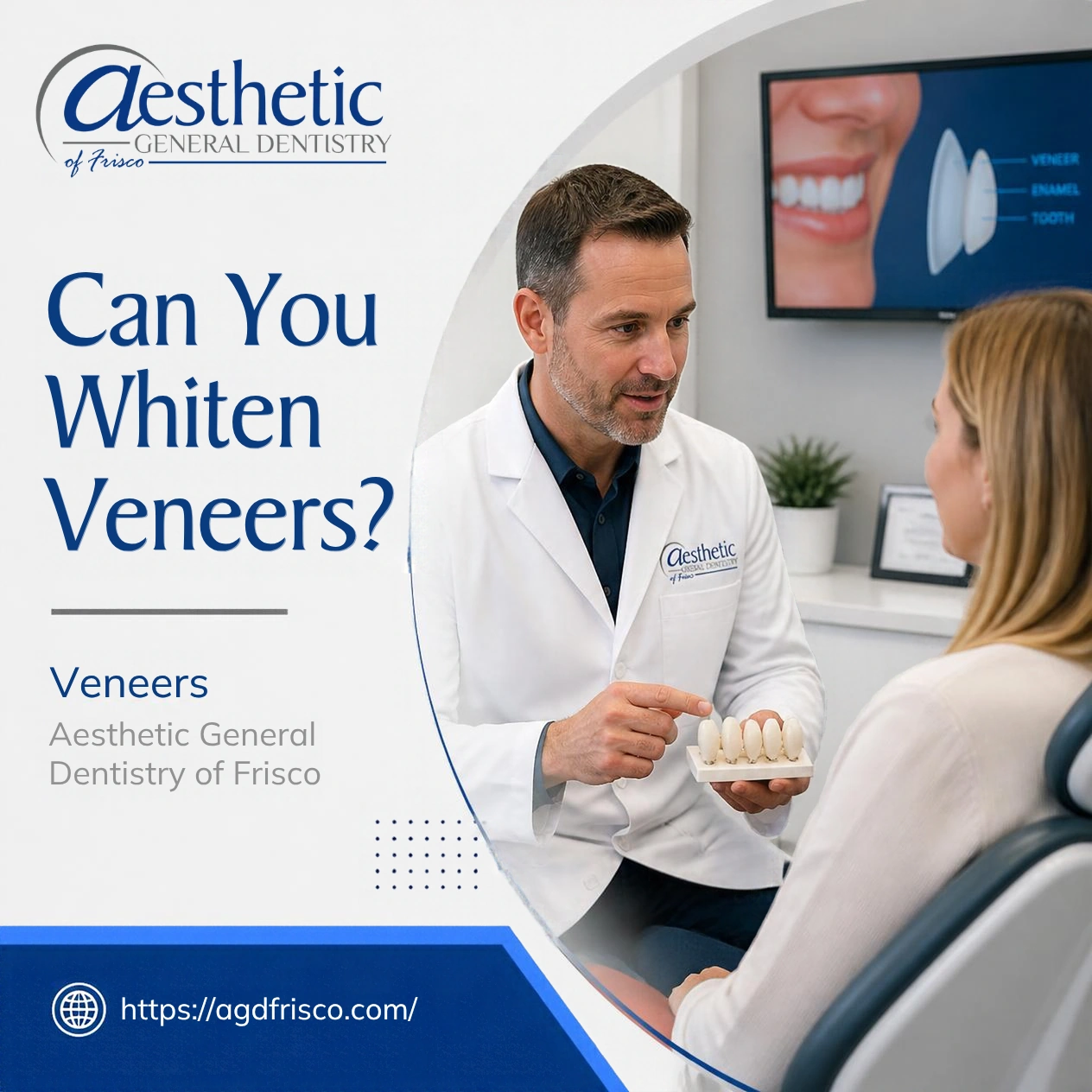 Can You Whiten Veneers?
