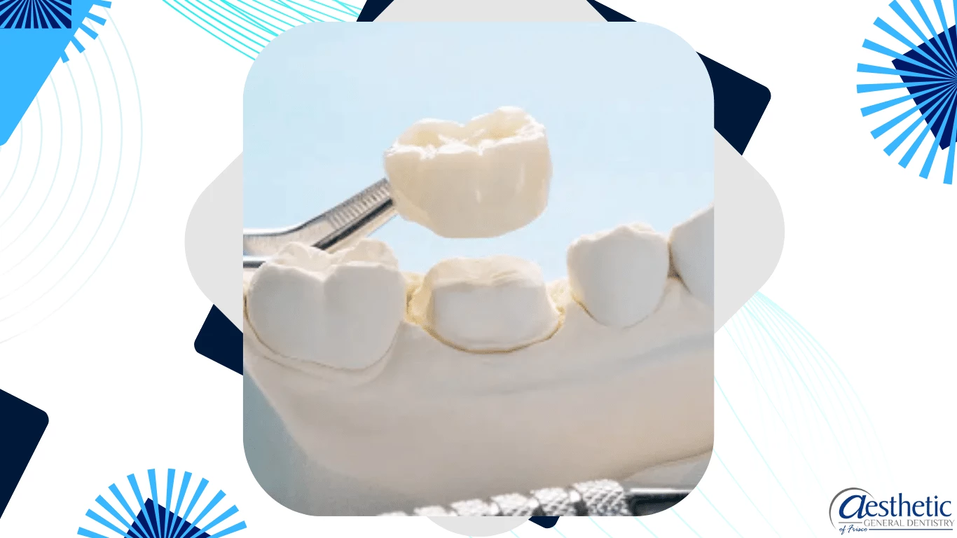 Dental Crowns Frisco TX Restore Your Smile's Functionality
