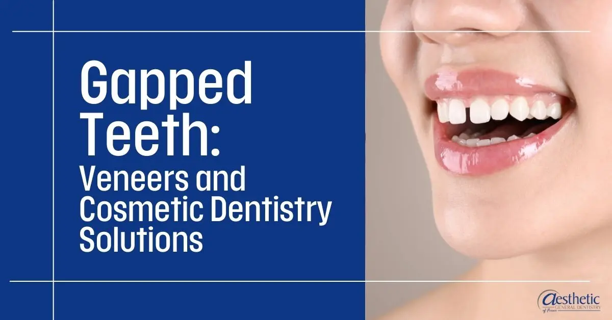 Gapped Teeth: Veneers and Cosmetic Dentistry Solutions