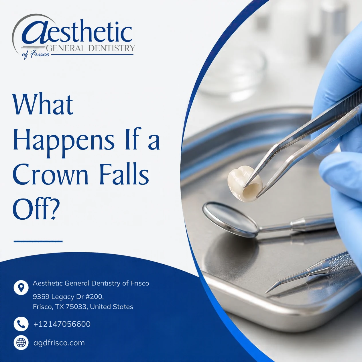What Happens If a Crown Falls Off?