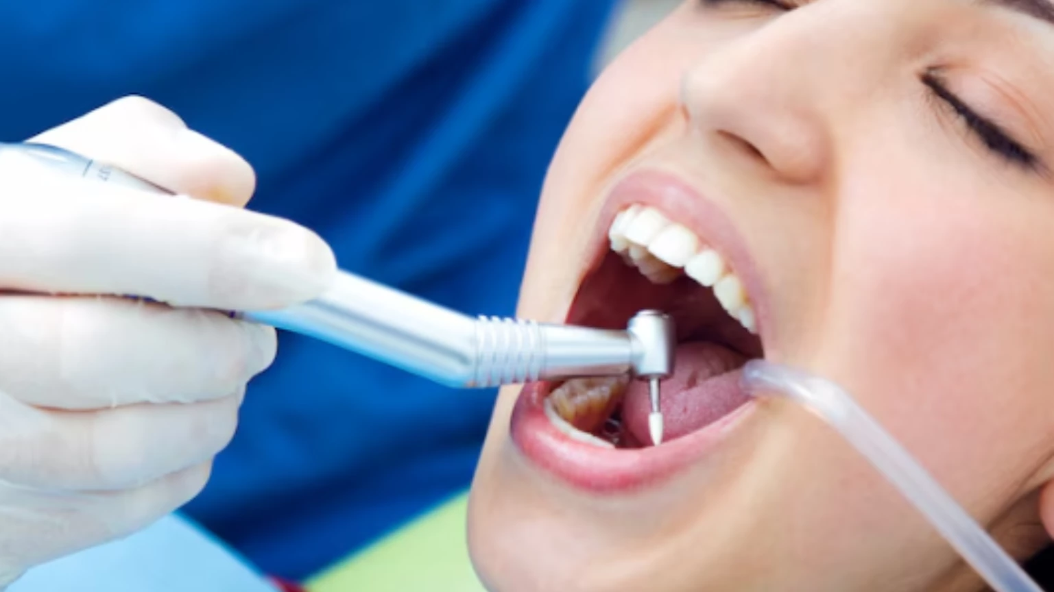 Where to Find the Best Teeth Cleaning Dentist Near Me