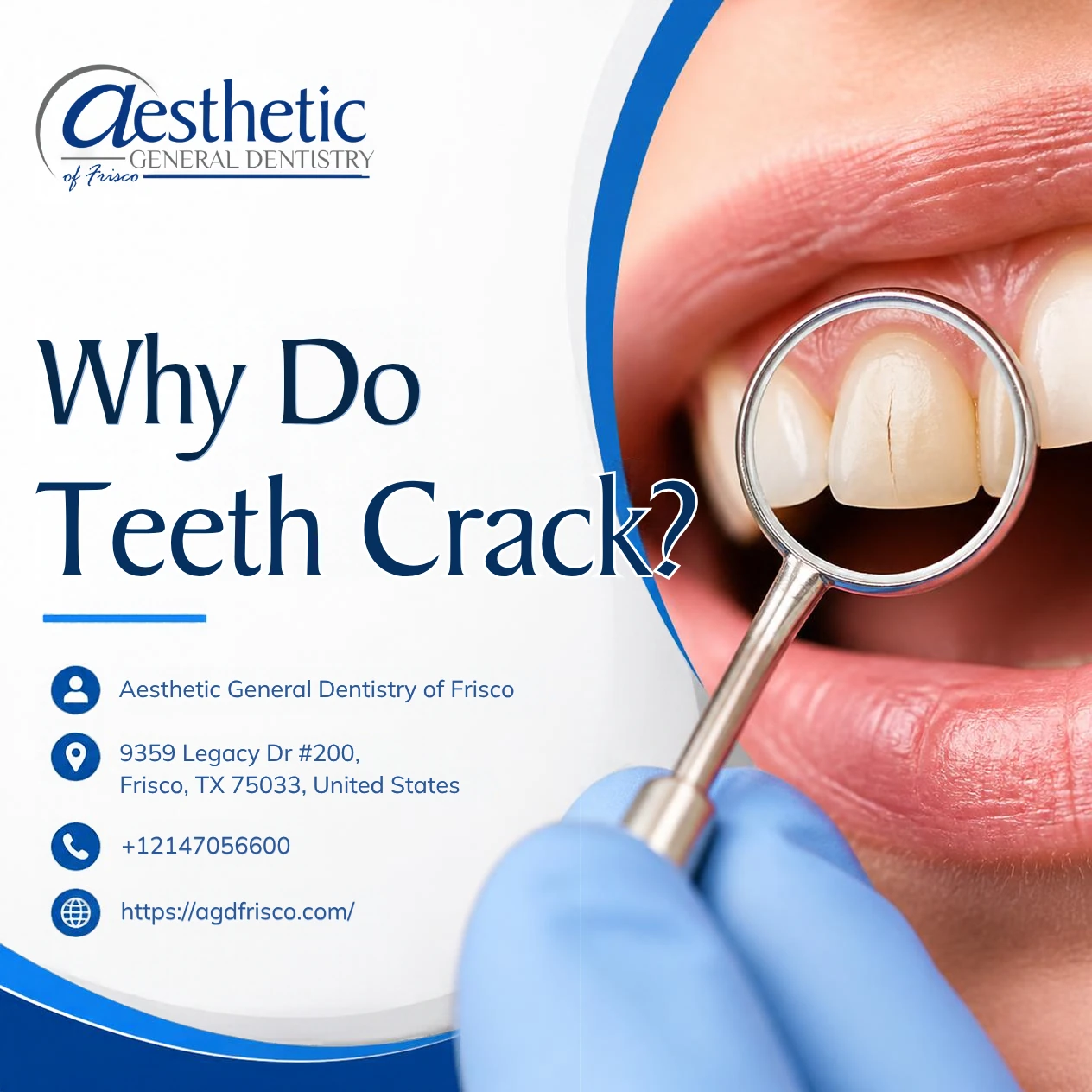 Why Do Teeth Crack?