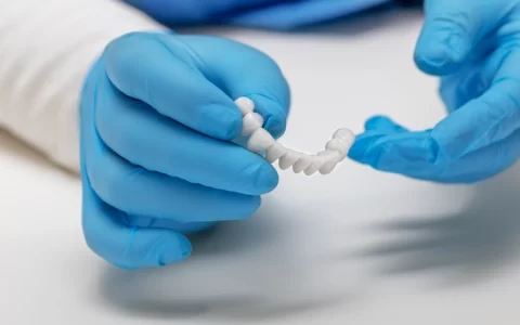 gloved hands holding dental implants